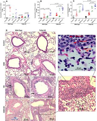 Tollip deficiency exaggerates airway type 2 inflammation in mice exposed to allergen and influenza A virus: role of the ATP/IL-33 signaling axis